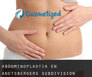 Abdominoplastia en Anetsberger's Subdivision
