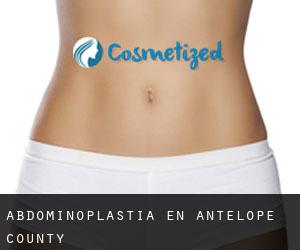 Abdominoplastia en Antelope County