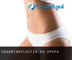 Abdominoplastia en Apopa