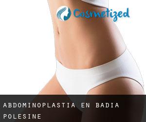 Abdominoplastia en Badia Polesine
