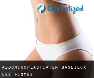 Abdominoplastia en Baslieux-lès-Fismes