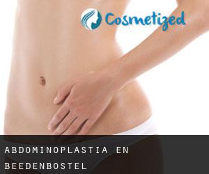 Abdominoplastia en Beedenbostel