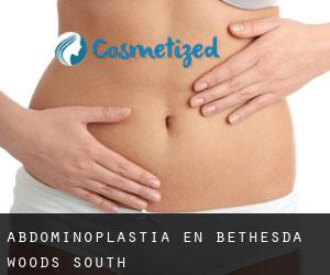 Abdominoplastia en Bethesda Woods South