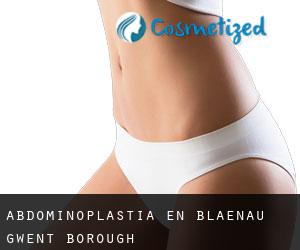 Abdominoplastia en Blaenau Gwent (Borough)