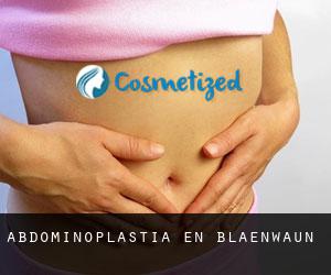 Abdominoplastia en Blaenwaun