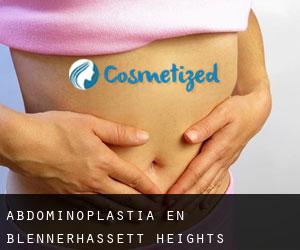 Abdominoplastia en Blennerhassett Heights