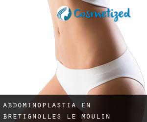 Abdominoplastia en Brétignolles-le-Moulin