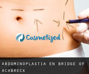Abdominoplastia en Bridge of Achbreck