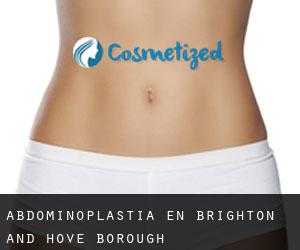Abdominoplastia en Brighton and Hove (Borough)