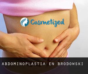Abdominoplastia en Brodowski