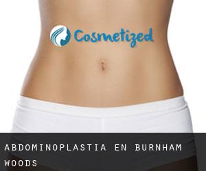 Abdominoplastia en Burnham Woods