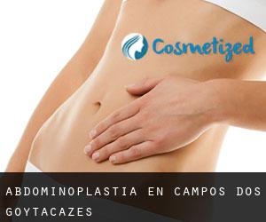 Abdominoplastia en Campos dos Goytacazes