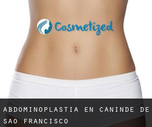 Abdominoplastia en Canindé de São Francisco