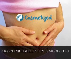 Abdominoplastia en Carondelet