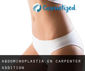 Abdominoplastia en Carpenter Addition