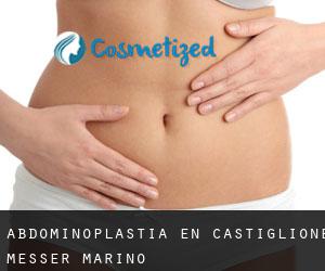 Abdominoplastia en Castiglione Messer Marino