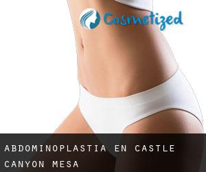 Abdominoplastia en Castle Canyon Mesa