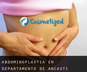 Abdominoplastia en Departamento de Ancasti