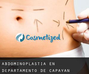 Abdominoplastia en Departamento de Capayán