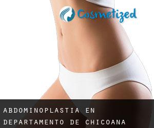Abdominoplastia en Departamento de Chicoana