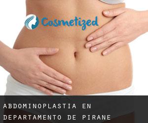 Abdominoplastia en Departamento de Pirané