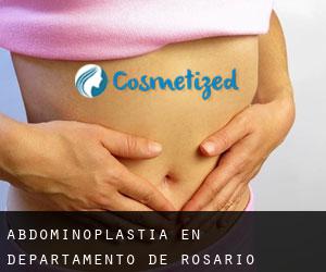 Abdominoplastia en Departamento de Rosario