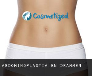 Abdominoplastia en Drammen