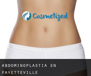 Abdominoplastia en Fayetteville