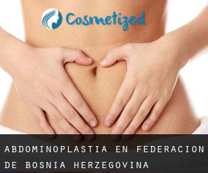 Abdominoplastia en Federacion de Bosnia-Herzegovina