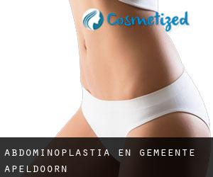 Abdominoplastia en Gemeente Apeldoorn