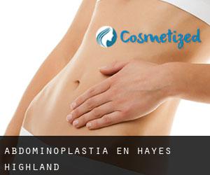 Abdominoplastia en Hayes Highland
