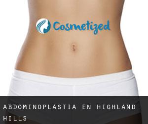 Abdominoplastia en Highland Hills