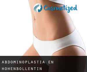 Abdominoplastia en Hohenbollentin