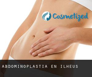 Abdominoplastia en Ilhéus Abdominoplastia en Ilhéus