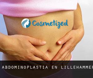 Abdominoplastia en Lillehammer