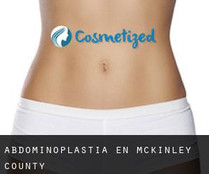 Abdominoplastia en McKinley County