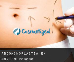 Abdominoplastia en Montenerodomo