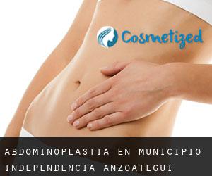 Abdominoplastia en Municipio Independencia (Anzoátegui)
