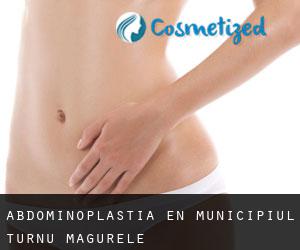 Abdominoplastia en Municipiul Turnu Magurele