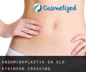 Abdominoplastia en Old Atkinson Crossing