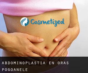 Abdominoplastia en Oraş Pogoanele
