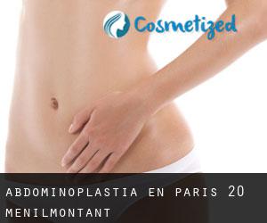 Abdominoplastia en Paris 20 Ménilmontant