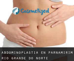 Abdominoplastia en Parnamirim (Rio Grande do Norte)