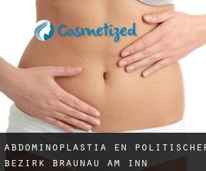 Abdominoplastia en Politischer Bezirk Braunau am Inn