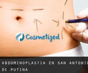 Abdominoplastia en San Antonio De Putina