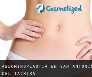 Abdominoplastia en San Antonio del Táchira