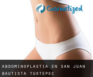 Abdominoplastia en San Juan Bautista Tuxtepec
