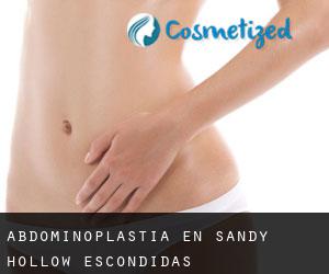 Abdominoplastia en Sandy Hollow-Escondidas