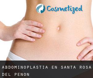 Abdominoplastia en Santa Rosa del Peñón