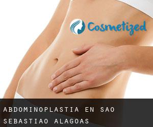 Abdominoplastia en São Sebastião (Alagoas)